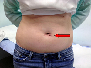 Advanced Minimally Invasive Laparoscopic Urological Surgery